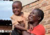 Malawi Mother Finds Love for Autistic Daughter Amid Sparse Support