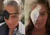 Dame Tracey Emin’s Emotional Recovery from Eye Surgery and Blindness