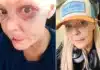 Gail Porter Recounts London Tube Stair Fall, Urges Online Kindness