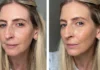 Why Skin Tints Are Replacing Foundation for Women Over 40